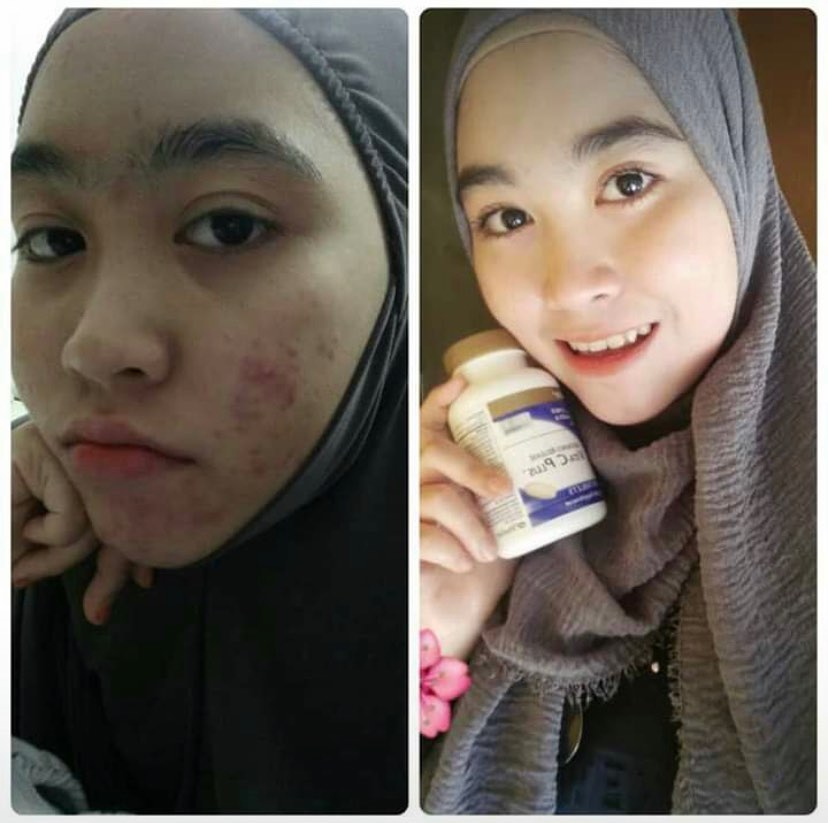 Beauty Skin After Consume Vitamin C
