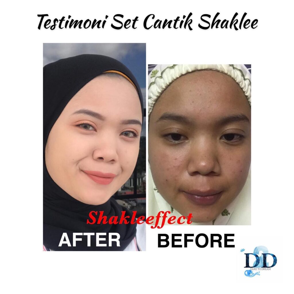 Testimoni Set Cantik Shaklee Kulit Makin Cerah