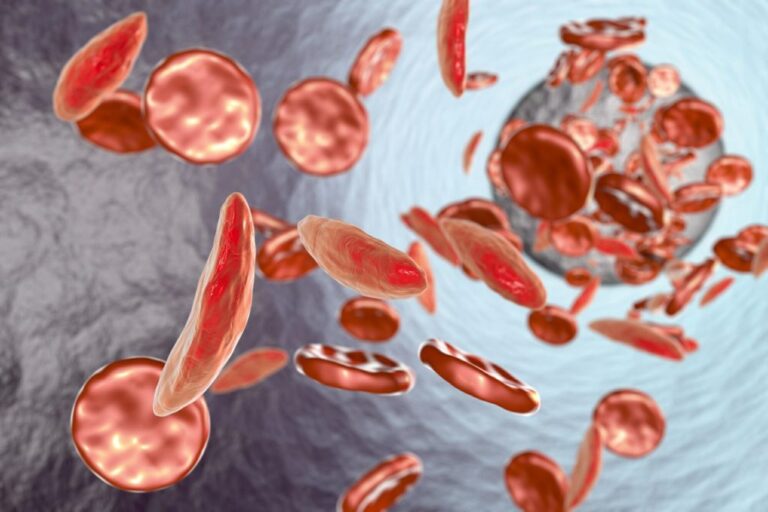 Anemia HB Rendah – Penyebab Badan Selalu Penat Walaupun Tidur Makan ...
