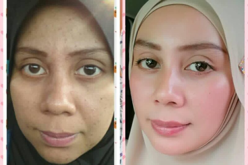 Kulit Cantik Halus Licin – Wajib Amalkan 2 Bahan Ini