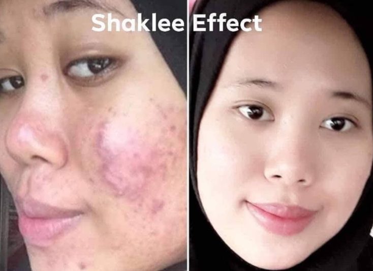 Kulit Badan Sihat – Kombinasi Hebat Protein dan Kolagen untuk Kecantikan Menyeluruh