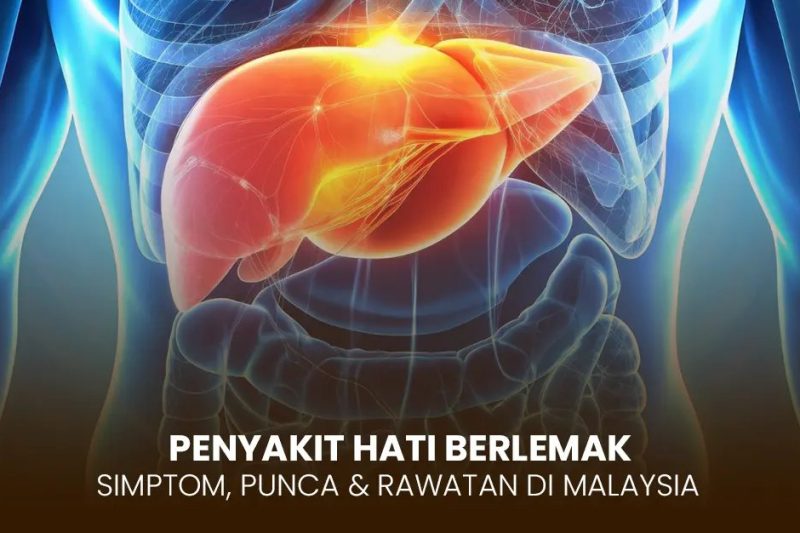 hati berlemak